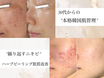 ルブラン(Lu'Bulan)