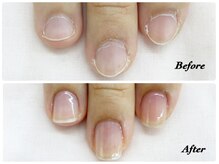 ちび爪など、ジェル・アクリルを使わずに美しい縦長な爪に！！