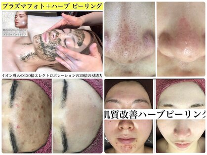 リリアーナ(LILIANA)の写真