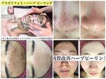 リリアーナ(LILIANA)