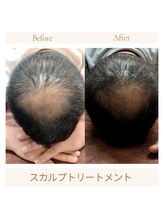 サロン ピューパ(Salon pupa)/スカルプケア