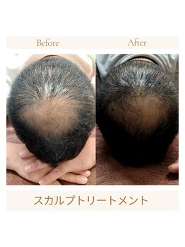 サロン ピューパ(Salon pupa)/スカルプケア