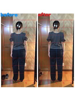春日部コアラ整体院/Before→After（姿勢）後面