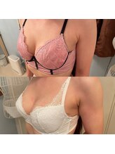 メゾン アンジュ(Maison Ange)/バストアップ症例／育乳