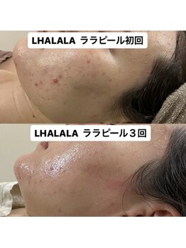 グラン ジュテ/LHALALA &nbsp;ララピール