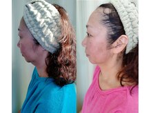 ソフィーム/エンビロンリフトフェイシャル