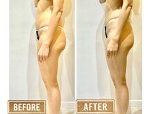 ビンナ 五反田店(Binna)/捻れをとって美脚、美尻に