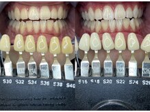 トウキョースワーズ 渋谷店(TOKYO SWRS)/#ホワイトニング #渋谷 #池袋