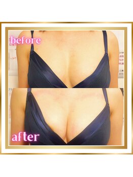 ジュエルリング(Jewel Ring)/バストアップ【恵比寿代官山】