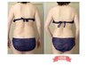都度払い【背中/二の腕コース】キャビ＋ラジオ派＋痩身マッサージ 5000円→