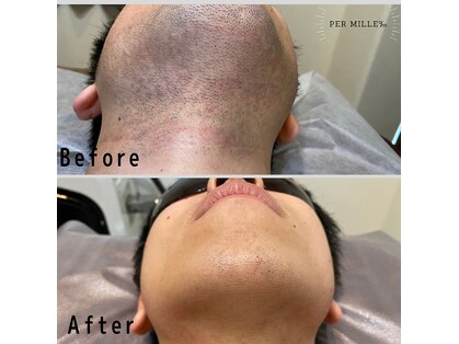 パーミル 弁天町店(per mille‰)の写真