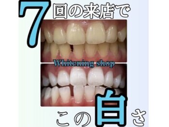 ホワイトニングショップ 京都駅前店/効果に絶対的な自身があります!
