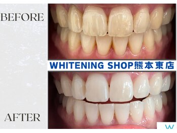ホワイトニングショップ熊本東店/ホワイトニングショップ熊本東店