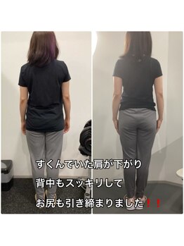 ナナ 大塚店(NANA)/BeforeAfter