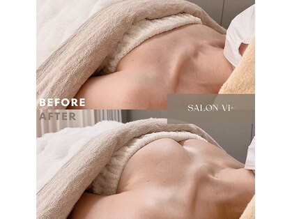 サロン ヴィプラス(SALON Vi+)の写真