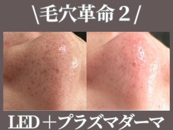 マヴィ くずは店(MavY.)/LEDとプラズマ