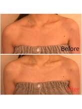 モアビューティー 紙屋町店/オールハンド！