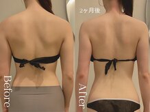 ユーフォリア グロウ(euphoria glow)