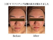 ナチュラーレ 天王寺店(Naturale)/美肌ニキビケア小顔フェイシャル