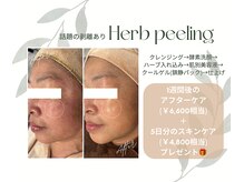 メディカルエステ サナーレ(Sanare)の雰囲気(話題のハーブピーリングで憧れのノーファンデ肌に導きます!)