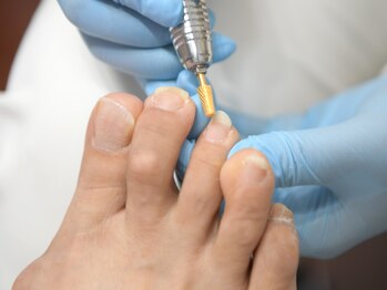 巻き爪専門ラボ 豊田店/爪切り