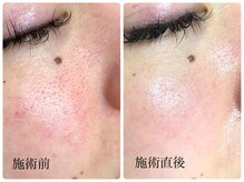 シェミー(CHEZ MEE)/潤い艶肌を即実感できます