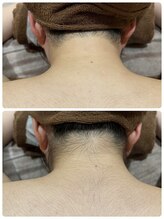 エステティック レイビス 青森店(RAYVIS)/意外と見られてる後ろ姿！