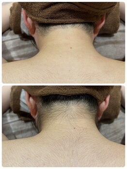 エステティック レイビス 青森店(RAYVIS)/意外と見られてる後ろ姿!