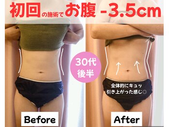 パリライム(parislime)/初回の施術だけで、お腹-3.5cm!