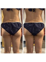 レヴール 京都四条烏丸店(Reveur)/裏腿施術で脚スッキリ