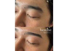 ベリーム(bereme)