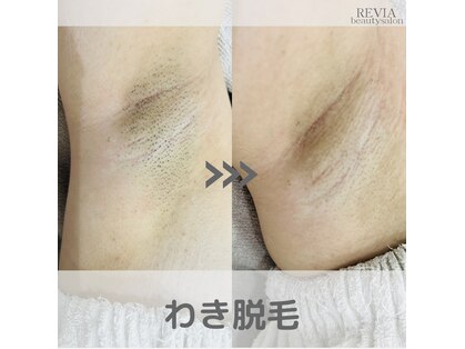 レヴィア(REVIA)の写真