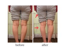 レディア(Re:Dear)/O脚X脚矯正