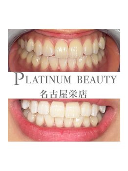 プラチナムビューティー 名古屋栄本店(PLATINUM BEAUTY)/お客様Before After