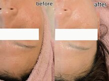 シャリル(charire)/白玉ツヤ肌/毛穴引き締め