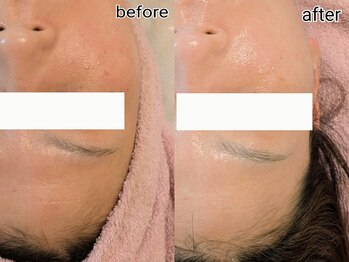 シャリル(charire)/白玉ツヤ肌/毛穴引き締め