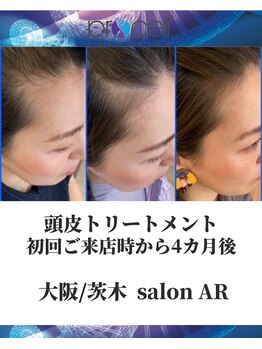 メンズサロンアール(AR)/プロセルセラピーズ