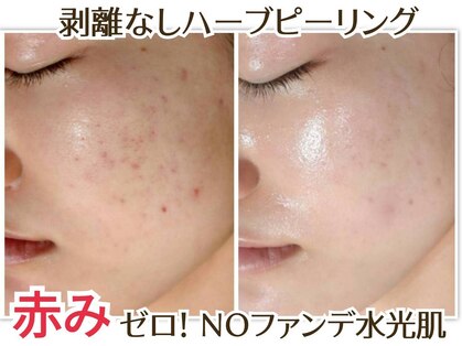 サロン ド ヒノキ(Salon de HINOKI)の写真