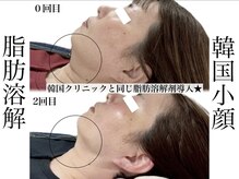 エステティック リベル キョウト 京都駅前店(Esthetic Liber Kyoto)/韓国小顔コルギ×脂肪分解