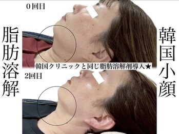 エステティック リベル キョウト 京都駅前店(Esthetic Liber Kyoto)/韓国小顔コルギ×脂肪分解