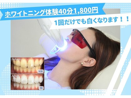 歯のホワイトニング専門店　ホワイトニングショップ各務原店【6/4 NEW OPEN（予定）】の写真