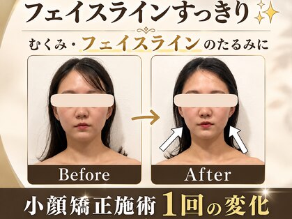 オリナサツキ(OlinaSatsuki)の写真