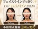 オリナサツキ(OlinaSatsuki)の写真