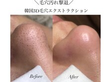 ルブラン(Lu'Bulan)の雰囲気（毛穴詰まりや黒角栓は韓国3D毛穴洗浄でゴッソリすっきり）