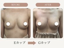 ウェルバスト(Well Bust)/【バストアップ例】E→Gカップ