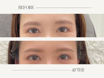 ナキ 富山店(Naki)/眉毛施術例 (眉毛Before.After)