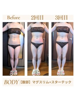 リコ 白金台(Liko)/まずは3回トライアル！