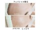 アンジュ(Anju)の写真