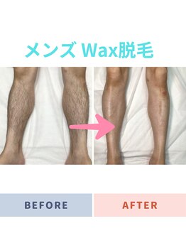 カルーナ 住吉店/メンズ Wax脱毛