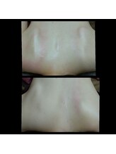 ビューティースリム タニダ/